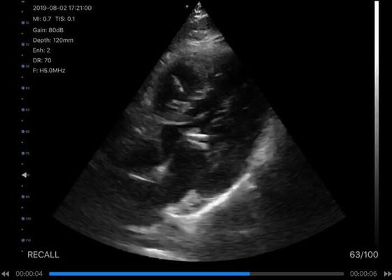 اسکنر اولتراسوند دستی 5G محدب: 3.5 ~ 5 مگاهرتز ، خطی: 7.5 ~ 10 مگاهرتز ، قلب: 2.5 ~ 5 مگاهرتز