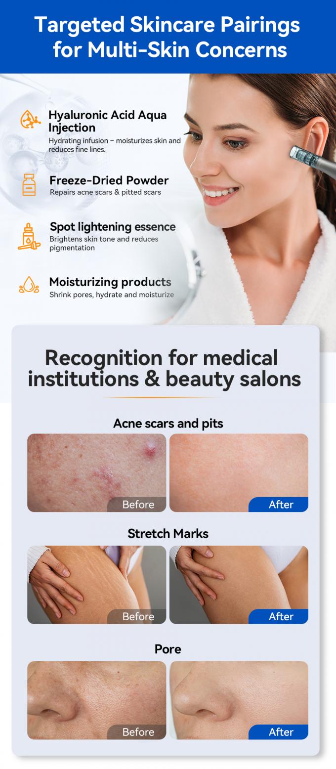 قلم درما میکرونیدل MTS Hydra Pen H5 دستگاه محبوب مراقبت از پوست ضد پیری جوانسازی پوست صورت سفید کننده کلاژن درمانی 7