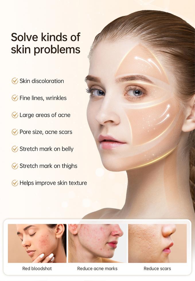 جدیدترین دستگاه خودکار سرمزن 4 قطبی EMS Hydra Pen H5 برای جوانسازی پوست صورت با استفاده از میکرونیدلینگ و تحریک تولید کلاژن 3