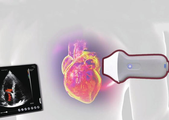 اسکنر اولتراسوند قابل حمل بی سیم PDI WiFi 128 Element